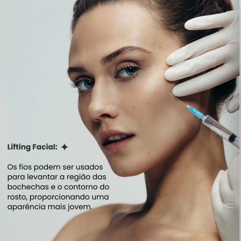 Lifting com Fios PDO em Itapiranga - Beleza e Firmeza para a Pele